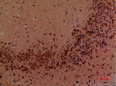 Fig.5. Immunohistochemical analysis of paraffin-embedded Mouse-brain, antibody was diluted at 1:100.