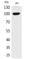 Fig. Western Blot analysis of 293 cells using Autotaxin Polyclonal Antibody. Secondary antibody (catalog#: A21020) was diluted at 1:20000.