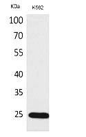 Fig. Western Blot analysis of K562 cells using IGFBP6 Polyclonal Antibody. Secondary antibody (catalog#: A21020) was diluted at 1:20000.