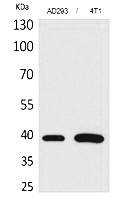 Fig.1. Western Blot analysis of AD293, 4T1 cells using Troponin T-C Polyclonal Antibody. Secondary antibody (catalog#: A21020) was diluted at 1:20000.