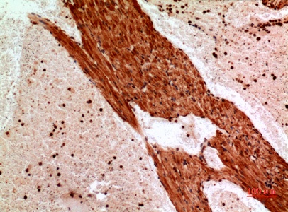 Fig.3. Immunohistochemical analysis of paraffin-embedded Mouse-heart, antibody was diluted at 1:100.