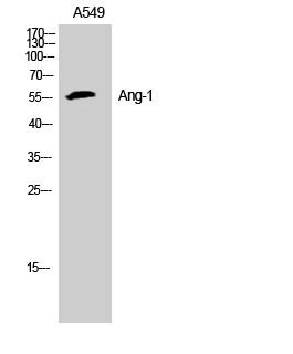 Fig.1. Western Blot analysis of A549, K562 cells using Ang-1 Polyclonal Antibody. Secondary antibody (catalog#: A21020) was diluted at 1:20000.