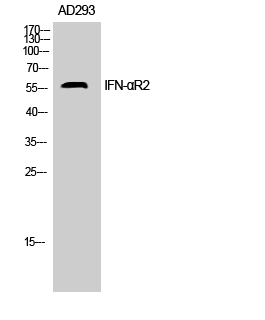 Fig.1. Western Blot analysis of AD293 cells using IFN-αR2 Polyclonal Antibody. Secondary antibody (catalog#: A21020) was diluted at 1:20000.
