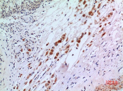 Fig.2. Immunohistochemical analysis of paraffin-embedded human-brain, antibody was diluted at 1:100.