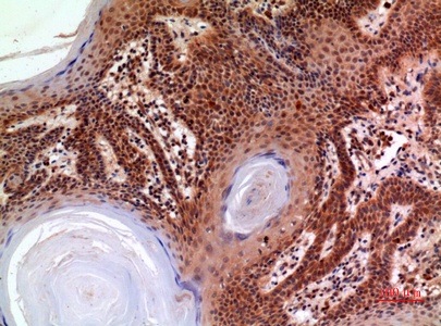 Fig.3. Immunohistochemical analysis of paraffin-embedded human-skin, antibody was diluted at 1:100.