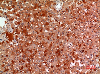 Fig.4. Immunohistochemical analysis of paraffin-embedded human-liver, antibody was diluted at 1:100.