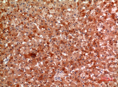 Fig.5. Immunohistochemical analysis of paraffin-embedded human-liver, antibody was diluted at 1:100.
