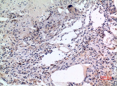 Fig.3. Immunohistochemical analysis of paraffin-embedded human-lung, antibody was diluted at 1:100.