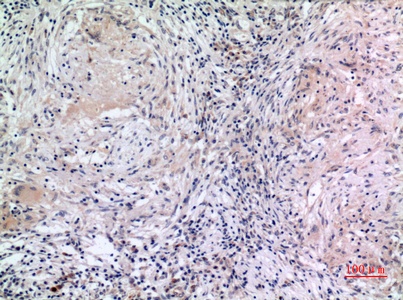 Fig.4. Immunohistochemical analysis of paraffin-embedded human-lung, antibody was diluted at 1:100.