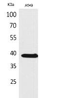 Fig.1. Western Blot analysis of A549 cells using NTCP Polyclonal Antibody. Secondary antibody (catalog#: A21020) was diluted at 1:20000.