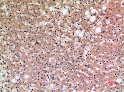 Fig.3. Immunohistochemical analysis of paraffin-embedded human-liver, antibody was diluted at 1:100.