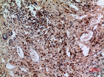 Fig.4. Immunohistochemical analysis of paraffin-embedded human-lung, antibody was diluted at 1:100.