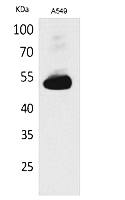 Fig.1. Western Blot analysis of A549 cells using Annexin VII Polyclonal Antibody. Secondary antibody (catalog#: A21020) was diluted at 1:20000.