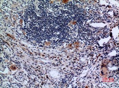 Fig.2. Immunohistochemical analysis of paraffin-embedded human-lung, antibody was diluted at 1:100.