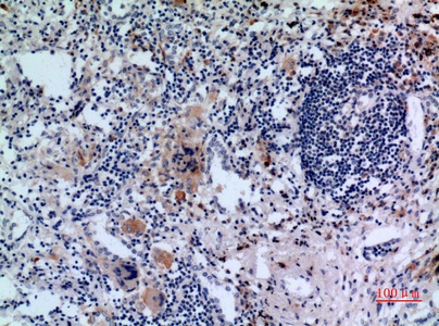 Fig.3. Immunohistochemical analysis of paraffin-embedded human-lung, antibody was diluted at 1:100.