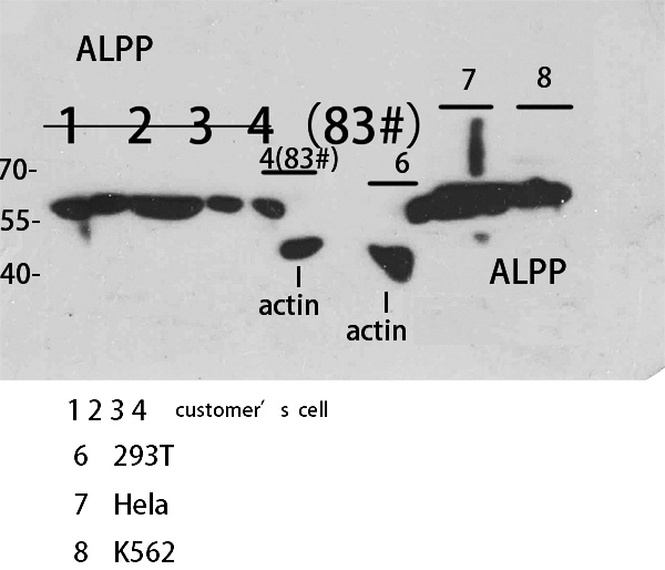Fig.2. Western Blot analysis of customer's sample using ALPP/ALPPL2 Polyclonal Antibody. Antibody was diluted at 1:2000. Secondary antibody (catalog#: A21020) was diluted at 1:20000.