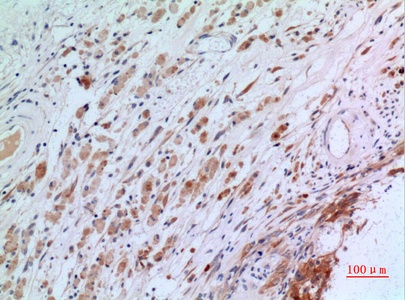 Fig.2. Immunohistochemical analysis of paraffin-embedded human-brain, antibody was diluted at 1:100.