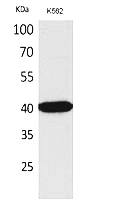 Fig. Western Blot analysis of K562 cells using Connexin-40 Polyclonal Antibody. Secondary antibody (catalog#: A21020) was diluted at 1:20000.