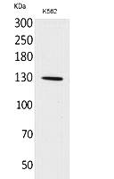 Fig.1. Western Blot analysis of K562 cells using Apaf-1 Polyclonal Antibody. Secondary antibody (catalog#: A21020) was diluted at 1:20000.