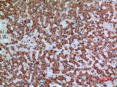 Fig.2. Immunohistochemical analysis of paraffin-embedded human-liver, antibody was diluted at 1:100.
