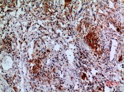 Fig.3. Immunohistochemical analysis of paraffin-embedded human-lung, antibody was diluted at 1:100.