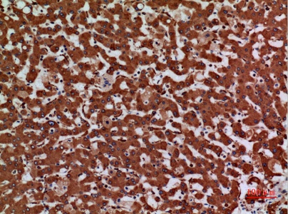 Fig.2. Immunohistochemical analysis of paraffin-embedded human-liver, antibody was diluted at 1:100.