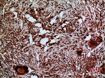 Fig.3. Immunohistochemical analysis of paraffin-embedded human-lung, antibody was diluted at 1:100.