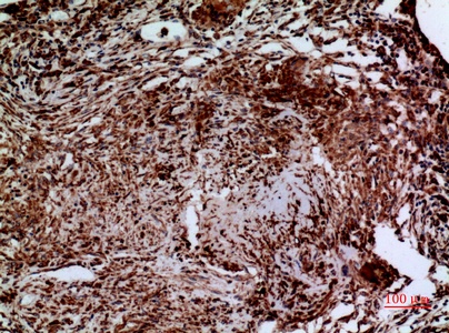 Fig.4. Immunohistochemical analysis of paraffin-embedded human-lung, antibody was diluted at 1:100.