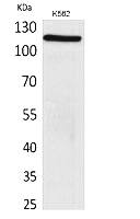 Fig.1. Western Blot analysis of K562 cells using Cryopyrin Polyclonal Antibody. Secondary antibody (catalog#: A21020) was diluted at 1:20000.