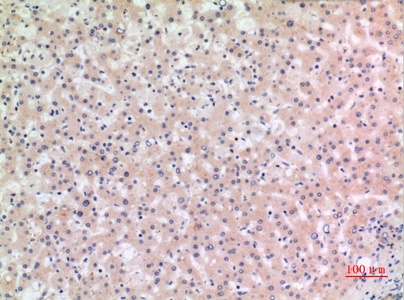 Fig.2. Immunohistochemical analysis of paraffin-embedded human-liver, antibody was diluted at 1:100.