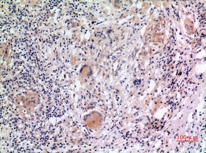 Fig.3. Immunohistochemical analysis of paraffin-embedded human-lung, antibody was diluted at 1:100.