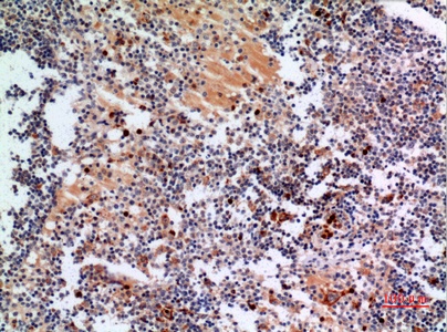 Fig.3. Immunohistochemical analysis of paraffin-embedded human-lymph-gland, antibody was diluted at 1:100.