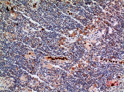 Fig.4. Immunohistochemical analysis of paraffin-embedded human-lymph-gland, antibody was diluted at 1:100.