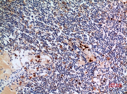 Fig.5. Immunohistochemical analysis of paraffin-embedded human-lymph-gland, antibody was diluted at 1:100.