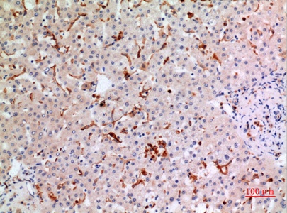 Fig.7. Immunohistochemical analysis of paraffin-embedded human-liver, antibody was diluted at 1:100.