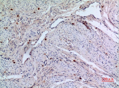 Fig.2. Immunohistochemical analysis of paraffin-embedded human-uterus, antibody was diluted at 1:100.