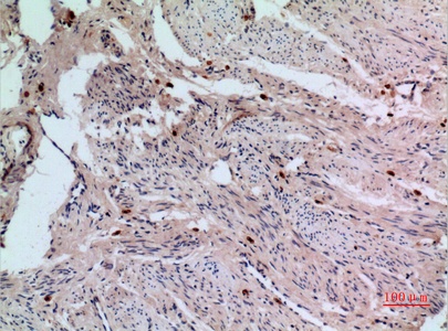 Fig.3. Immunohistochemical analysis of paraffin-embedded human-uterus, antibody was diluted at 1:100.