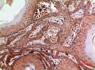 Fig.4. Immunohistochemical analysis of paraffin-embedded human-skin, antibody was diluted at 1:100.