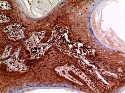 Fig.5. Immunohistochemical analysis of paraffin-embedded human-skin, antibody was diluted at 1:100.