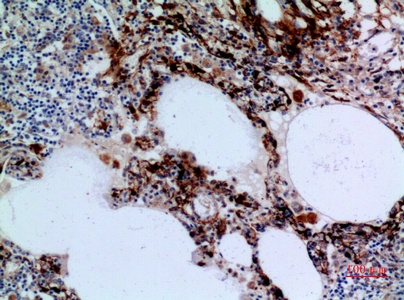 Fig.3. Immunohistochemical analysis of paraffin-embedded human-lung, antibody was diluted at 1:100.