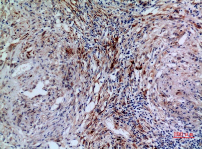 Fig.4. Immunohistochemical analysis of paraffin-embedded human-lung, antibody was diluted at 1:100.