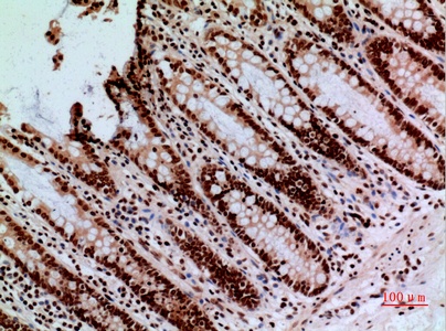 Fig.4. Immunohistochemical analysis of paraffin-embedded human-colon, antibody was diluted at 1:100.