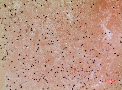 Fig.5. Immunohistochemical analysis of paraffin-embedded human-colon, antibody was diluted at 1:100.