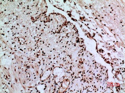 Fig.6. Immunohistochemical analysis of paraffin-embedded human-colon, antibody was diluted at 1:100.