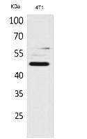 Fig.1. Western Blot analysis of 4T1 cells using AACT Polyclonal Antibody. Secondary antibody (catalog#: A21020) was diluted at 1:20000.