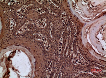 Fig.2. Immunohistochemical analysis of paraffin-embedded human-skin, antibody was diluted at 1:100.