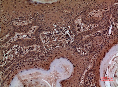 Fig.3. Immunohistochemical analysis of paraffin-embedded human-skin, antibody was diluted at 1:100.