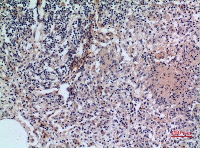 Fig.2. Immunohistochemical analysis of paraffin-embedded human-lung, antibody was diluted at 1:100.