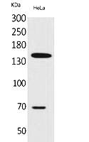 Fig.1. Western Blot analysis of hela cells using CD42b Polyclonal Antibody. Secondary antibody (catalog#: A21020) was diluted at 1:20000.