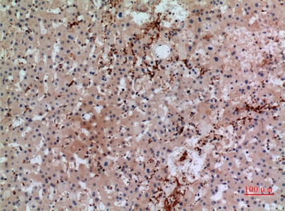 Fig.3. Immunohistochemical analysis of paraffin-embedded human-liver, antibody was diluted at 1:100.